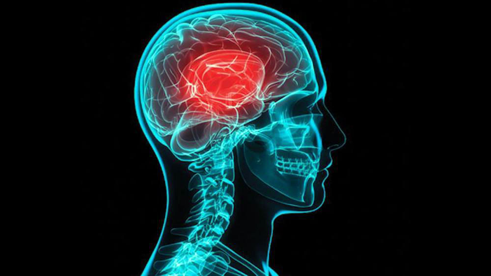 Сотрясение мозга, черепно-мозговая травма
