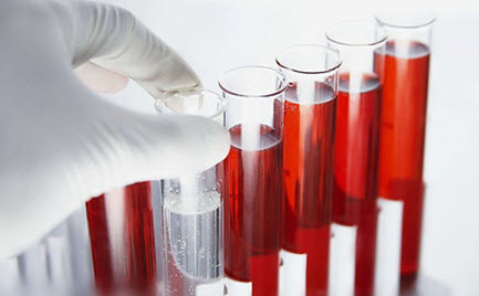 анализ крови на паразитов